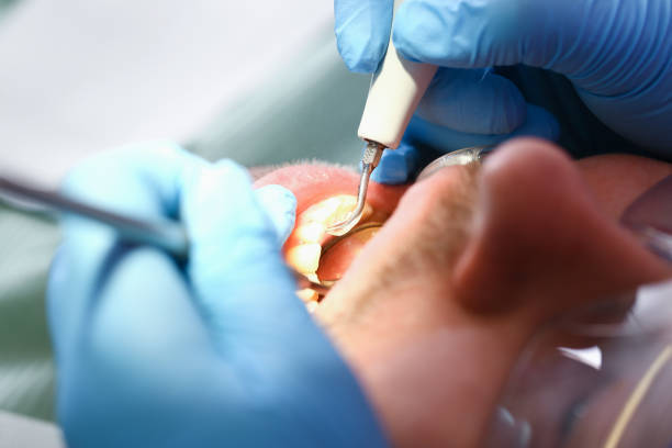 Best Emergency Treatment for Toothache in Hope, IN
